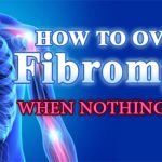 How To Overcome Fibromyalgia, When Nothing Else Works